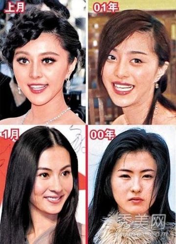 明星化妆师揭开女明星在整形手术中的面部变化