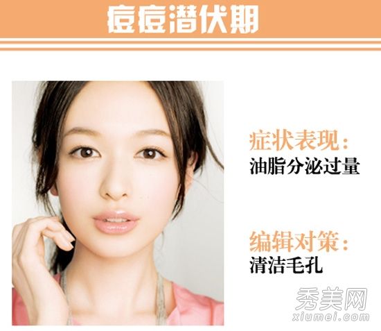 痤疮形成的三个阶段教会你如何消炎和修复