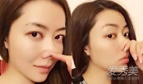 这些明星玩他们的脸只是为了证明他们是自然的吗?