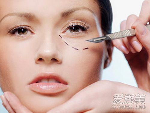 在取出小袋子三天后，再也没有人会说他有青蛙眼睛了。