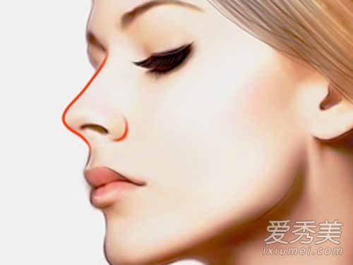 整形外科最大的错误:你认为整形外科的错误识别