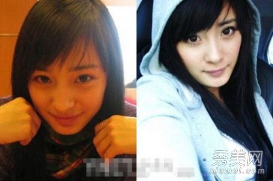 明星整形手术计数销毁死灵(大陆)