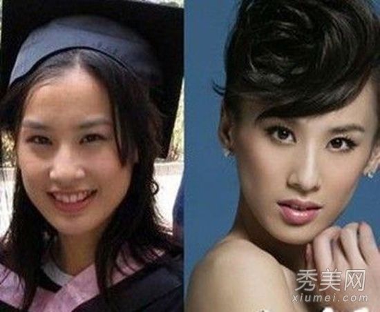 黄圣依的“第二十二条婚姻规则”斗鸡眼与马脸转型史