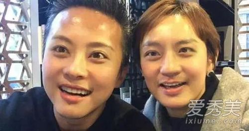 孙力和邓超已经公开接受了整形手术。这对夫妇承认了!