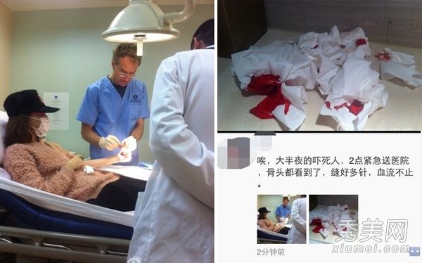 唐嫣怀疑爱情伤害和自残邱泽的3个绯闻女友美女PK