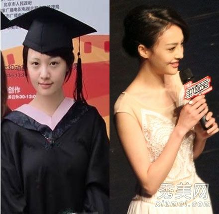 郑爽·姚迪整容后看起来像个婴儿