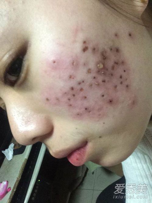 只有当一个人了解自己和自己的敌人时，他才能在“与粉刺斗争”的过程中赢得每一场战斗