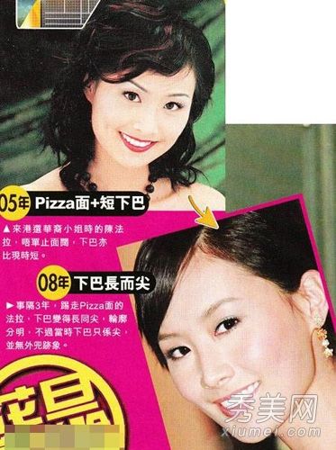 TVB二线女演员变得对整容上瘾