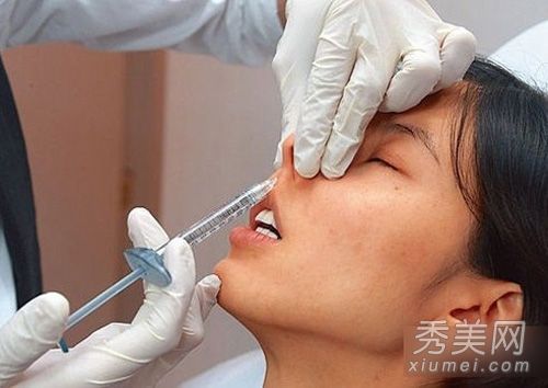 TVB陈思琪整容手术流程图女星整容手术后遗症清单