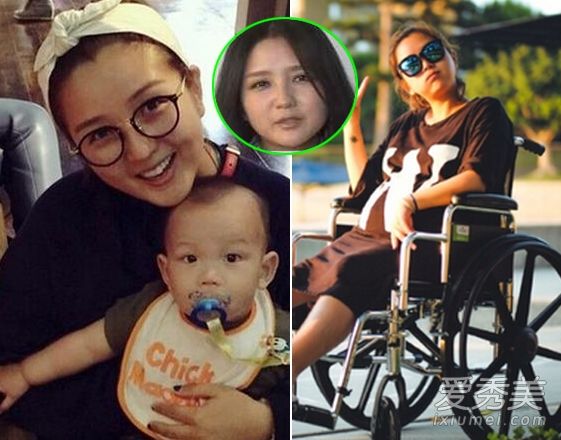 何杰怀的第二个孩子脸肿，手也肿了。这位女演员怀孕期间的样子极其丑陋。