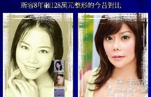 大S小强女演员在整形手术前后完全不同