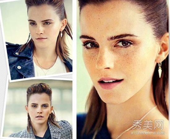 24岁的艾玛怎么会长雀斑呢？