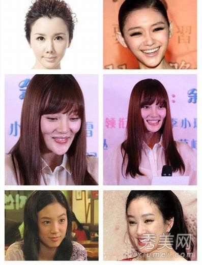 大李小璐女演员在整形手术中变成僵尸