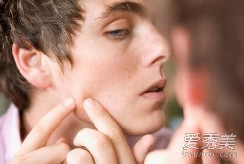 为什么我又长粉刺了？痤疮的原因及解决方法