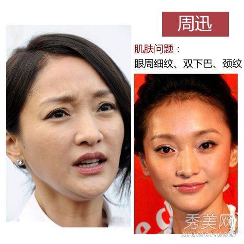 忽视抗衰老和保养娃娃脸的女演员将成为波义耳