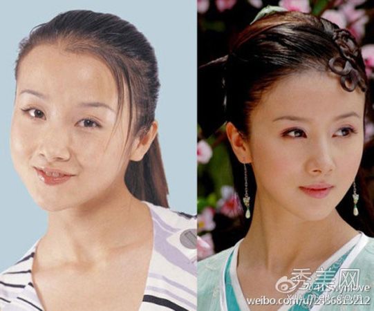 二线女演员哭丧着脸整容不红