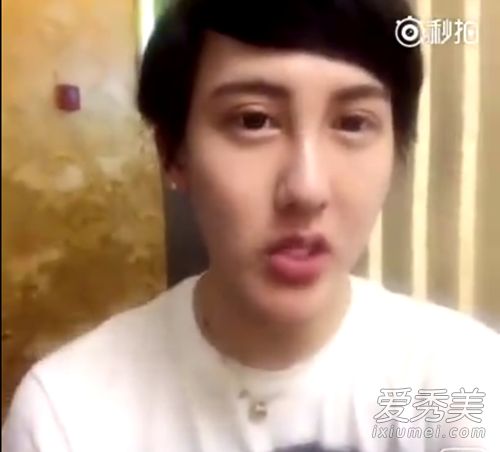 刘籽辰发现没有整形手术视频流出“专业”医生