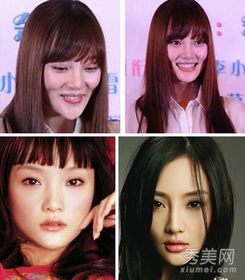 李小璐霍斯言姐妹整形手术的秘密