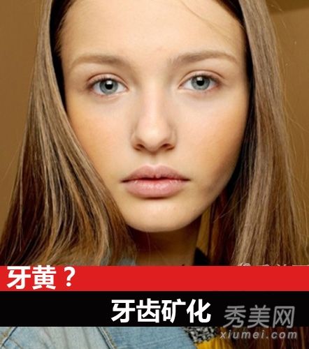 女人的黄牙太致命了，教你4种有效美白牙齿的方法