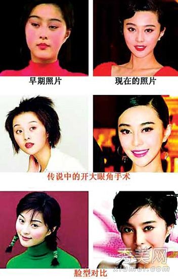 网友揭秘范冰冰整容真相