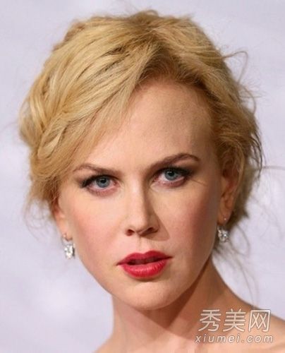 女演员敢于承认微孔板肉毒杆菌引起的面部僵硬