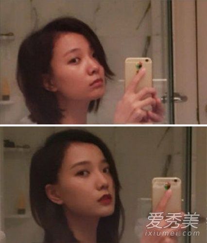 王分享她的整容经验