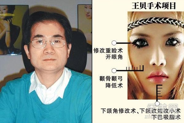 图为整容手术过程中的明星。平民疯狂整形手术