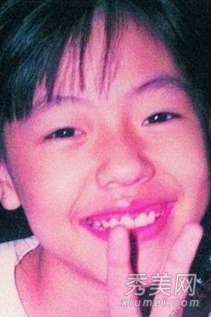 杨丞琳郑爽婴儿老照片揭示牙齿妹妹的蜕变历史