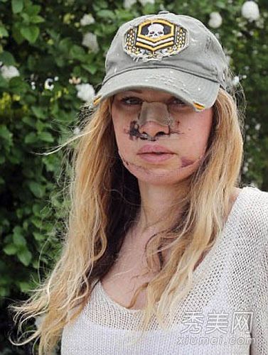 英国超模350次荒唐整形手术(照片)