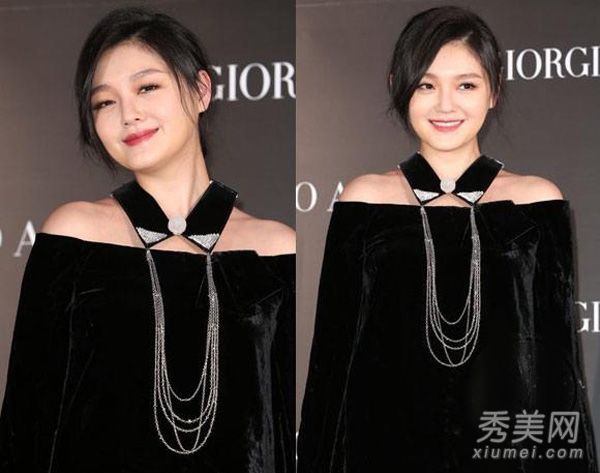 大S力综合征未孕面部水肿疑似微整形后遗症