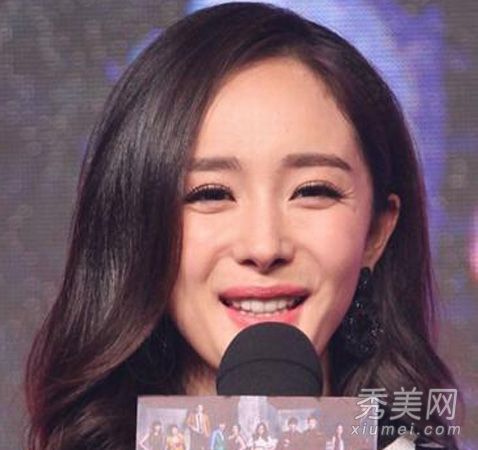 26岁的杨蜜鱼尾纹暴露眼睛细纹怎么保养？
