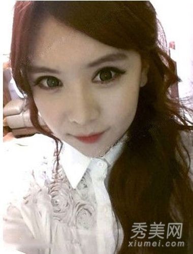 整形手术案例:双眼皮+V线手术整形经验