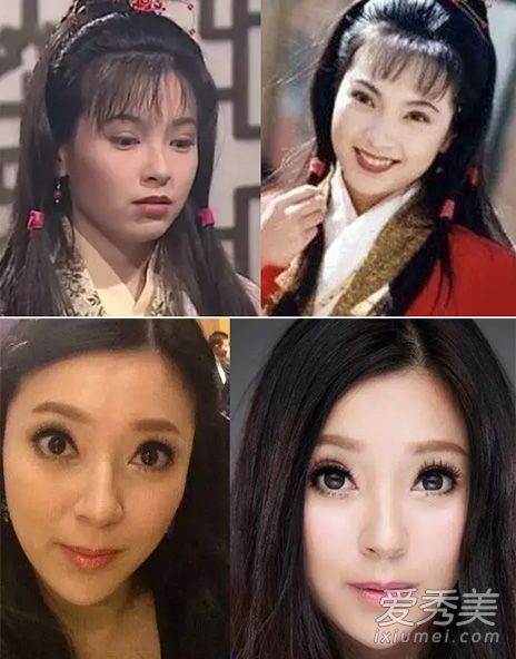 金庸的女孩:傅明宪整形手术失败+朱茵·李若彤老了