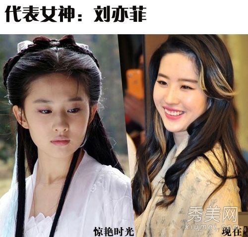 刘志玲正在变老，有很多皮肤问题。