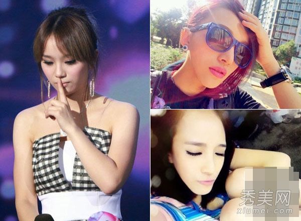 照片显示了整形手术或吸脂手术前后李媛希的圆脸？