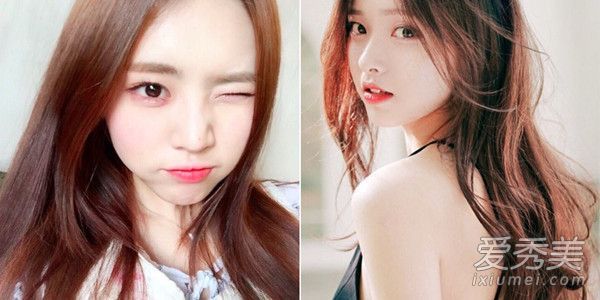 只要三步关键护肤方法解决痤疮问题