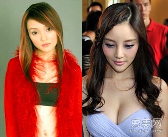 这位女演员被怀疑做过整形手术，长着一张大脸和一个小乳房，这是假的吗？