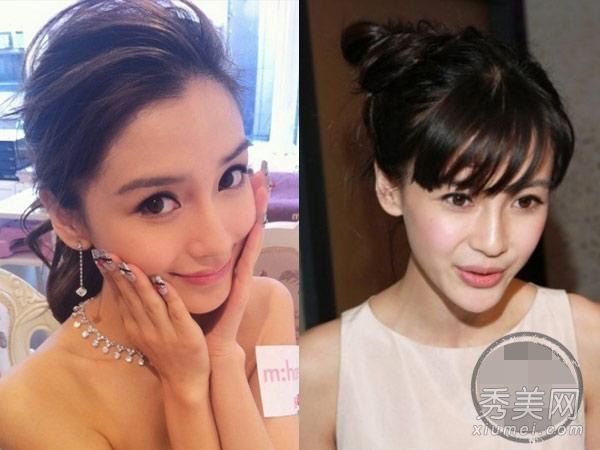 婴儿被怀疑在14岁开始整形手术