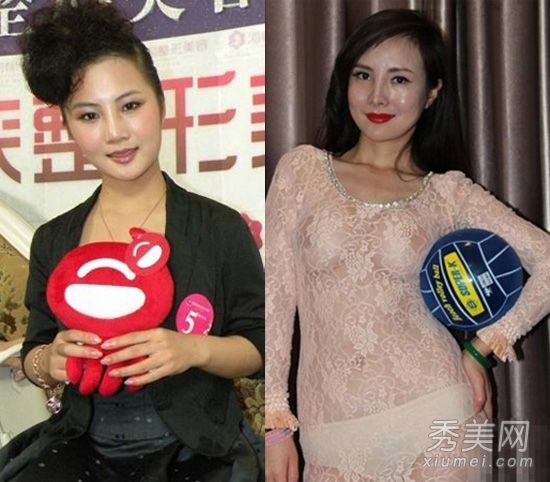 邓建国为“整容女人”的两个妻子爱整容