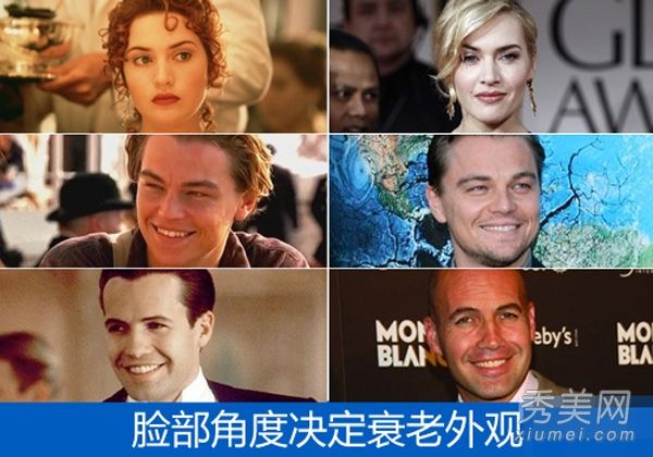 防止面部轮廓松弛,细纹,毛孔粗大,10岁