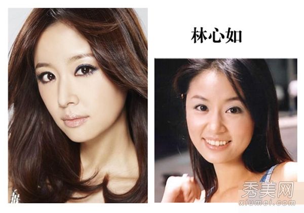 圆脸女演员v面秘密消除水肿的8步按摩练习