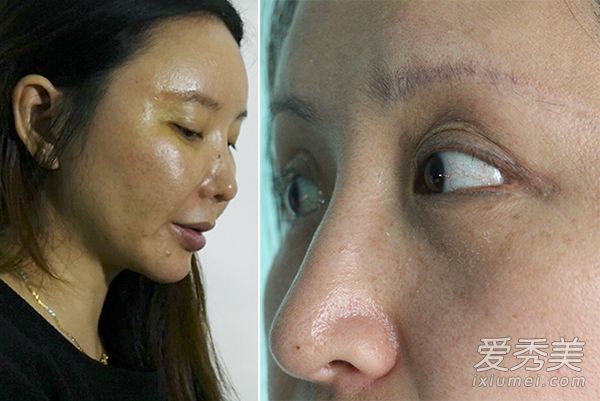 韩国的整形手术真的有那么好吗？