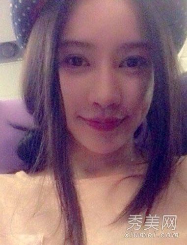 双爽宝宝整容三年;平坦的胸部变成美丽的胸部