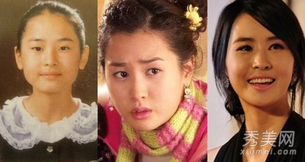 明星的脸很僵硬，下巴很尖，因为他看起来越来越丑。