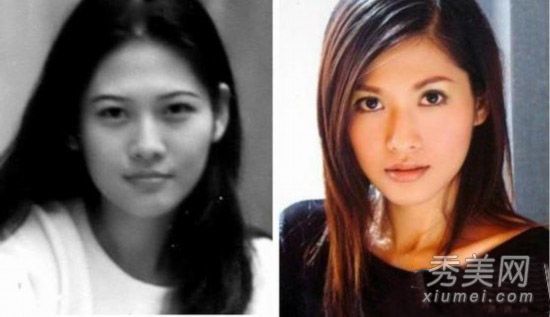 沈星通过“捉奸”发现了沈星整容手术前后的对比