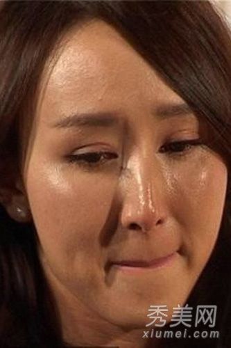 沈星、胡静、孙菲菲涉嫌整容失败、面部扭曲(照片)