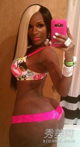 整形手术未能成为“面子”黑市整形手术的惨痛代价