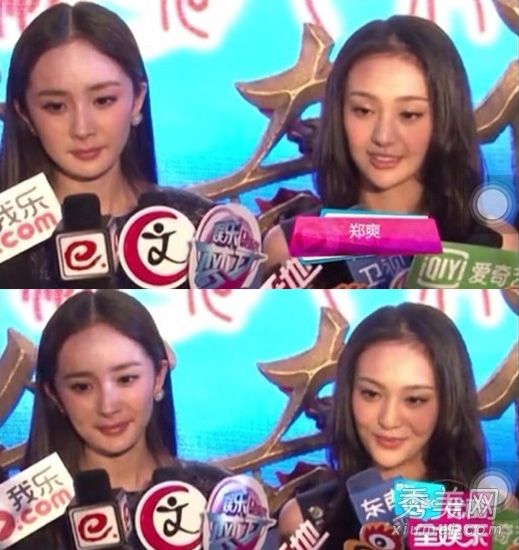 郑爽整形手术+爱公开暴露眼睛和嘴唇整形手术