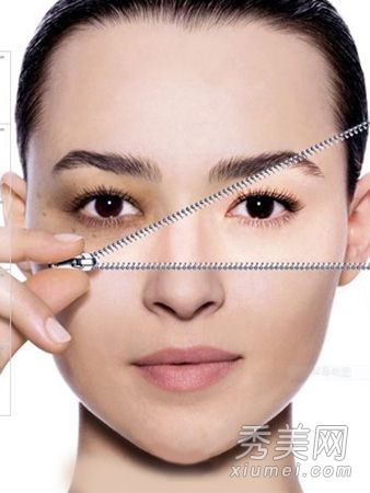 如何治疗眼角下垂？