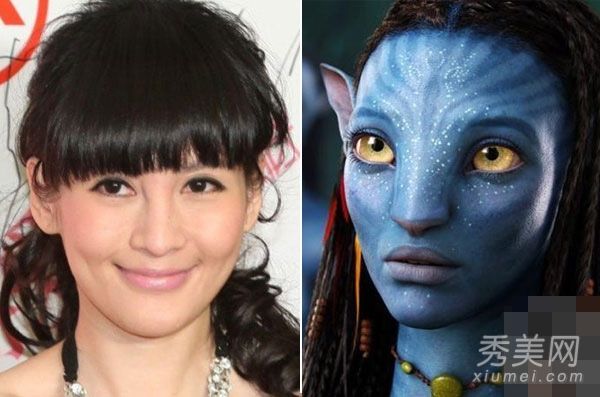 沈星怀疑隆鼻和阿凡达展示了10年的整形手术